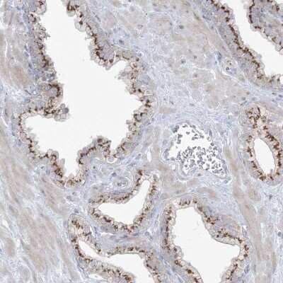 Immunohistochemistry-Paraffin: AFTPH Antibody [NBP2-38227]