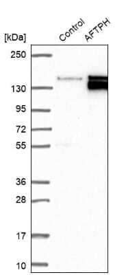 Western Blot: AFTPH Antibody [NBP1-82209]