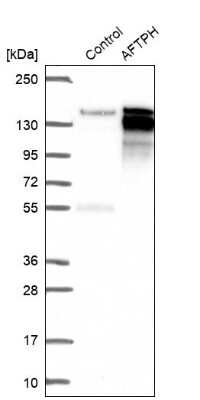 Western Blot: AFTPH Antibody [NBP2-38227]