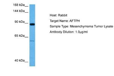 Western Blot: AFTPH Antibody [NBP2-84405]