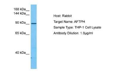 Western Blot: AFTPH Antibody [NBP2-84407]