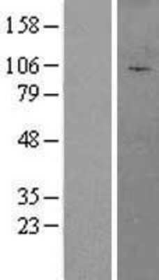 Western Blot: AFTPH Overexpression Lysate [NBL1-07376]