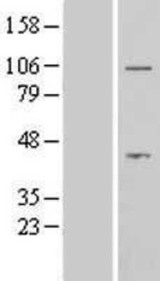 Western Blot: AFTPH Overexpression Lysate [NBL1-07377]