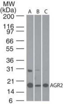 Western Blot: AG-2/AGR2 AntibodyAzide Free [NBP2-27392]