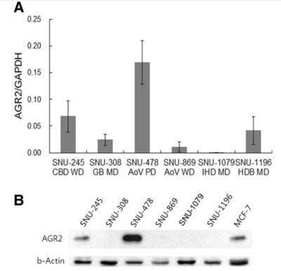 Western Blot: AG-2/AGR2 AntibodyAzide Free [NBP2-27392]