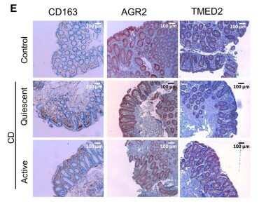 Immunohistochemistry: AG-2/AGR2 Antibody - BSA Free [NBP1-05936]