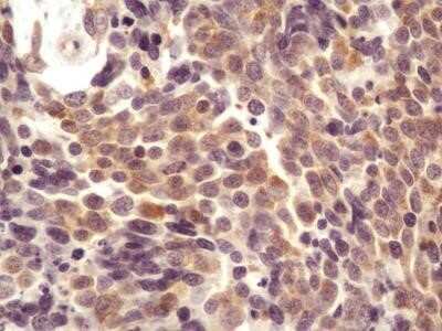 Immunohistochemistry: AG-2/AGR2 Antibody (10E2) - Azide and BSA Free [NBP2-80564]