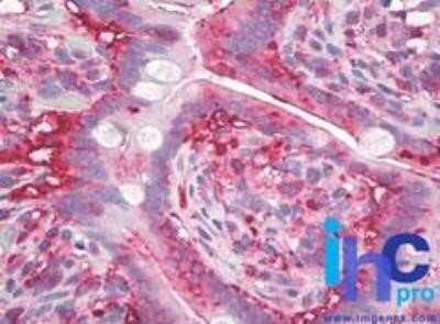 Immunohistochemistry-Paraffin: AG-2/AGR2 Antibody (10E2) - Azide and BSA Free [NBP2-80564]