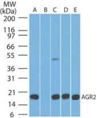 Western Blot: AG-2/AGR2 Antibody (10E2)Azide and BSA Free [NBP2-80564]