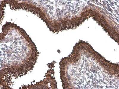 Immunohistochemistry-Paraffin: AG-2/AGR2 Antibody (GT5812) [NBP3-13593]