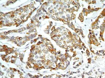 Immunohistochemistry-Paraffin: AG-2/AGR2 Antibody [NBP2-27393]