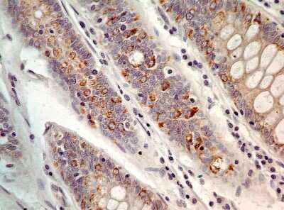 Immunohistochemistry-Paraffin: AG-2/AGR2 Antibody [NBP2-27393]