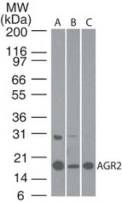 Western Blot: AG-2/AGR2 Antibody [NBP2-27393]