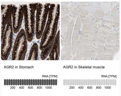 Immunohistochemistry-Paraffin: AG-2/AGR2 Antibody [NBP1-89212]