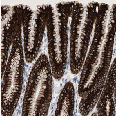 Immunohistochemistry-Paraffin: AG-2/AGR2 Antibody [NBP1-89212]
