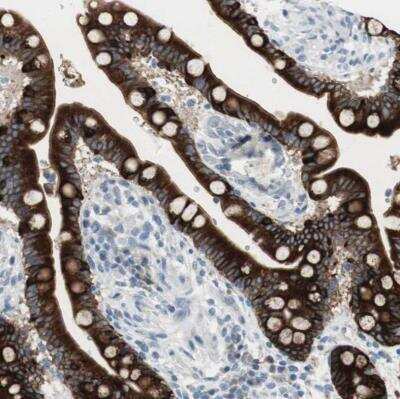 Immunohistochemistry-Paraffin: AG-2/AGR2 Antibody [NBP1-89212]
