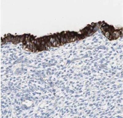 Immunohistochemistry-Paraffin: AG-2/AGR2 Antibody [NBP1-89212]