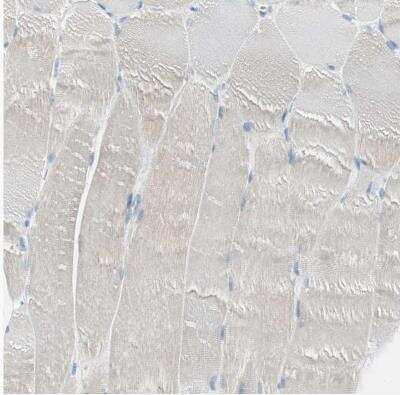 Immunohistochemistry-Paraffin: AG-2/AGR2 Antibody [NBP1-89212]