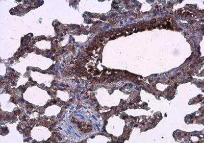 Immunohistochemistry-Paraffin: AG-3/AGR3 Antibody [NBP2-15307]
