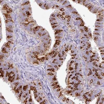 Immunohistochemistry-Paraffin: AG-3/AGR3 Antibody [NBP2-47555]