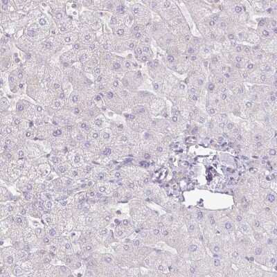 Immunohistochemistry-Paraffin: AG-3/AGR3 Antibody [NBP2-47555]