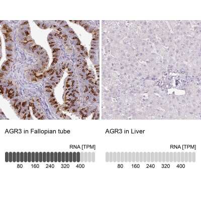 Immunohistochemistry-Paraffin: AG-3/AGR3 Antibody [NBP2-47555]