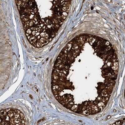 Immunohistochemistry-Paraffin: AGA Antibody [NBP1-88865]
