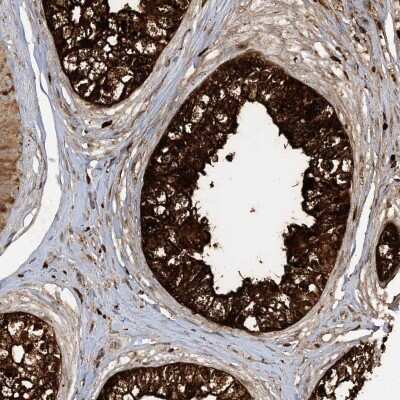 Immunohistochemistry-Paraffin: AGA Antibody [NBP1-88866]