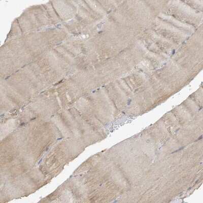 Immunohistochemistry-Paraffin: AGA Antibody [NBP1-88866]