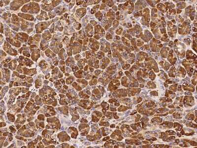 Immunohistochemistry-Paraffin: AGA Antibody [NBP2-99967]