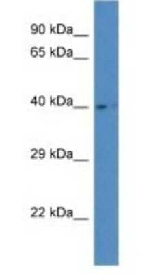 Western Blot: AGA Antibody [NBP1-79881]