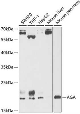 Western Blot: AGA AntibodyBSA Free [NBP3-04887]