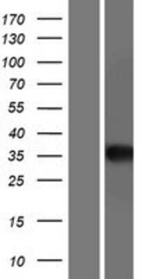 Western Blot: AGA Overexpression Lysate [NBP2-10248]