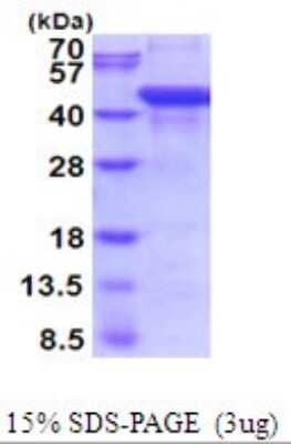 SDS-PAGE: Recombinant Human AGA His Protein [NBP2-51984]