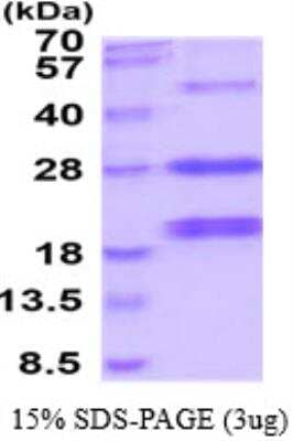 SDS-PAGE: Recombinant Human AGA His Protein [NBP2-52631]