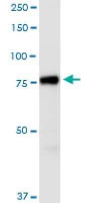 Western Blot: AGAP1 Antibody (3F2) [H00116987-M01-100ug]