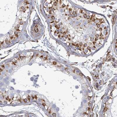 Immunohistochemistry: AGAP1 Antibody [NBP2-49005]