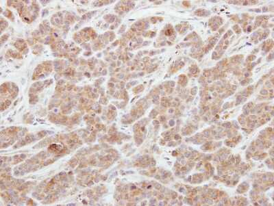Immunohistochemistry-Paraffin: AGAP1 Antibody [NBP2-15305]