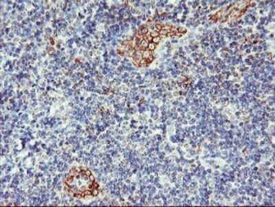 Immunohistochemistry: AGAP1 Antibody (OTI4E8) - Azide and BSA Free [NBP2-72357]