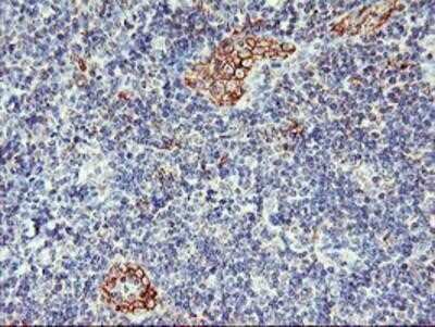 Immunohistochemistry-Paraffin: AGAP1 Antibody (OTI4E8) [NBP2-01708]