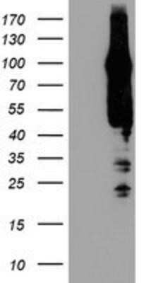 Western Blot: AGAP1 Antibody (OTI4E8) [NBP2-01708]