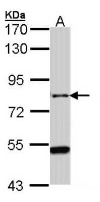 Western Blot: AGAP1 Antibody [NBP1-31261]