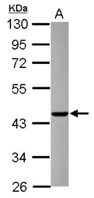 Western Blot: AGAP1 Antibody [NBP2-15305]