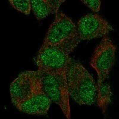 Immunocytochemistry/ Immunofluorescence: AGAP2 Antibody [NBP3-16972]