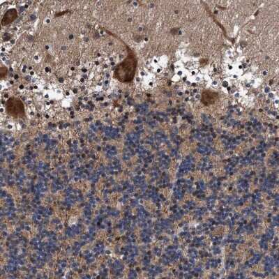 Immunohistochemistry-Paraffin: AGAP2 Antibody [NBP1-85686]