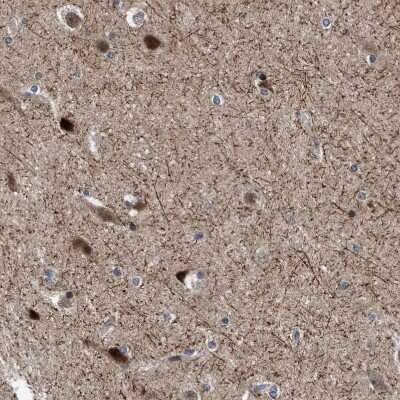 Immunohistochemistry-Paraffin: AGAP2 Antibody [NBP1-85686]