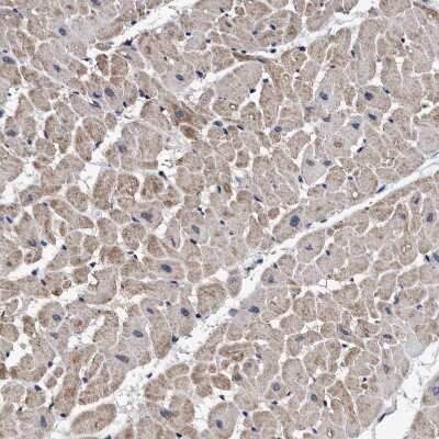 Immunohistochemistry-Paraffin: AGAP2 Antibody [NBP1-85686]