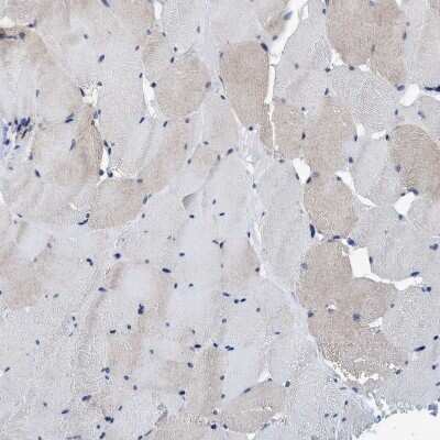 Immunohistochemistry-Paraffin: AGAP2 Antibody [NBP1-85686]
