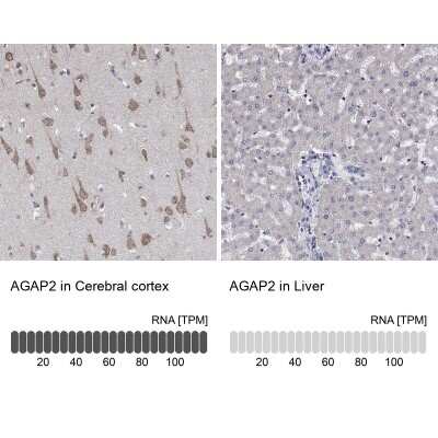 Immunohistochemistry-Paraffin: AGAP2 Antibody [NBP3-16972]
