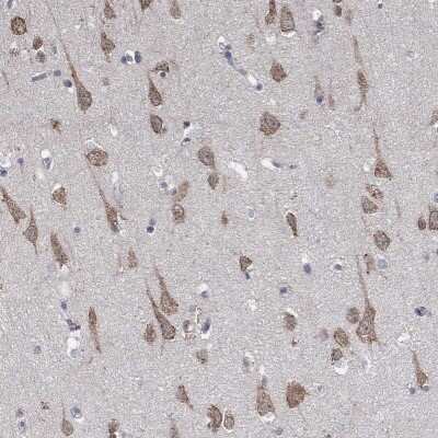 Immunohistochemistry-Paraffin: AGAP2 Antibody [NBP3-16972]